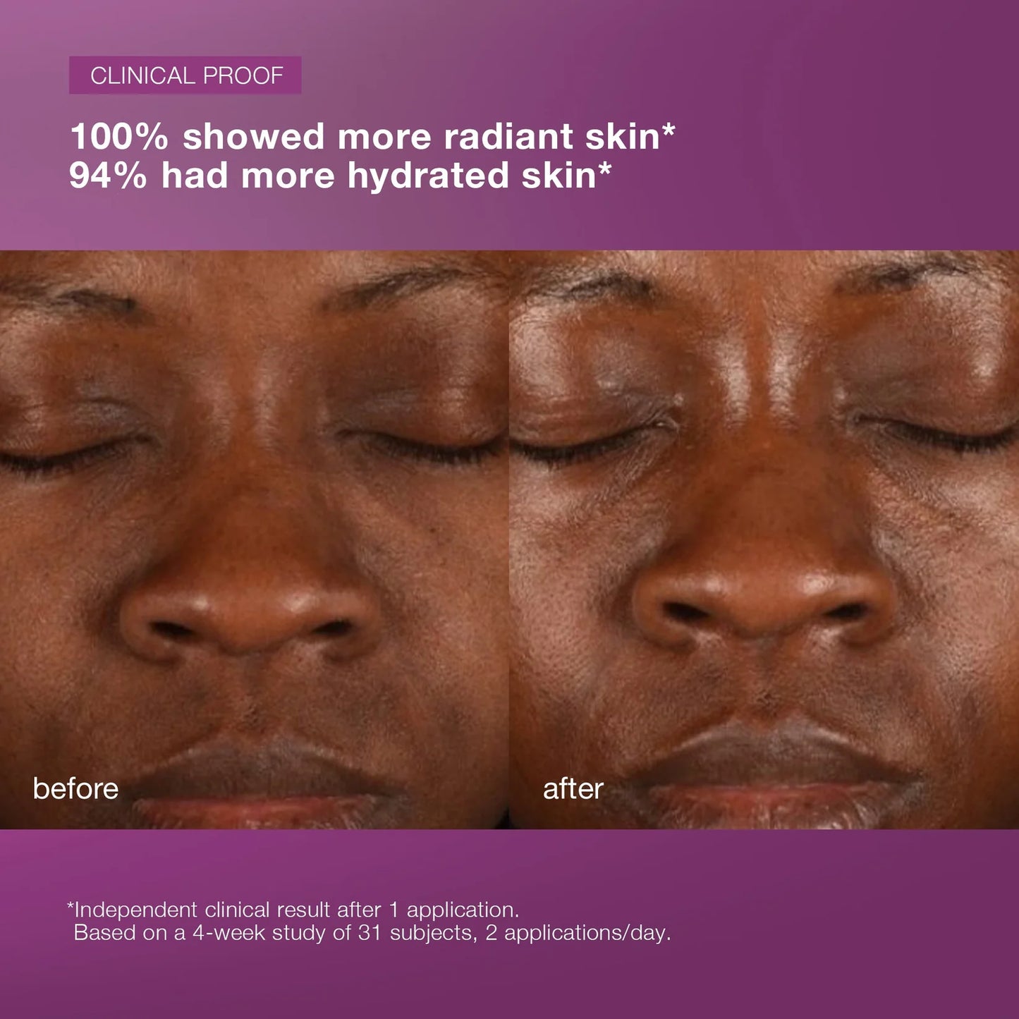 Multivitamin Power Recovery Cream - Sylph Beauty