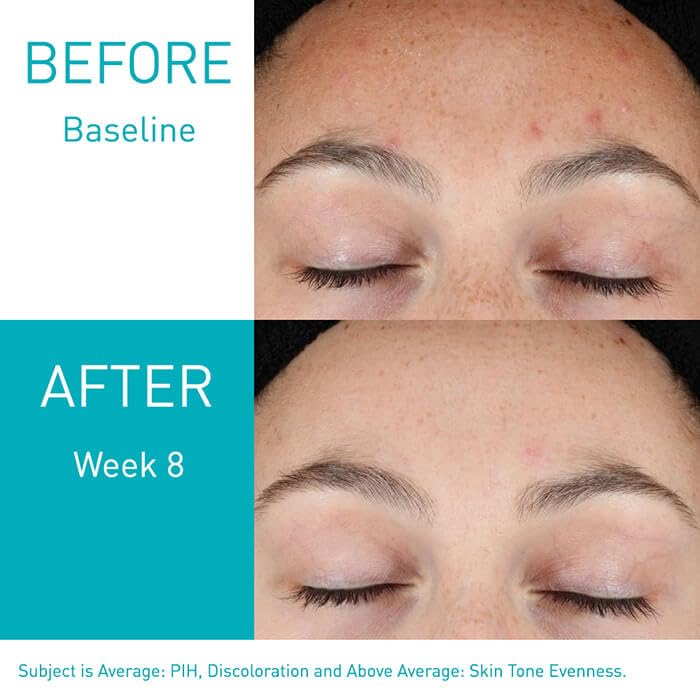 Resurfacing Retinol Serum - Sylph Beauty