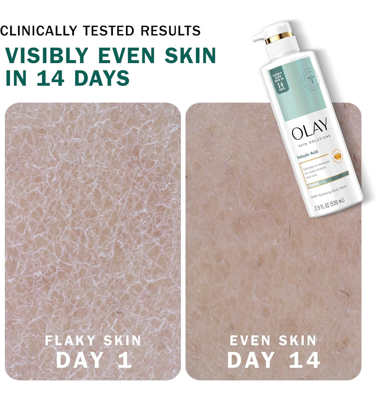 Skin Solutions Salicylic Acid Body Wash - Sylph Beauty