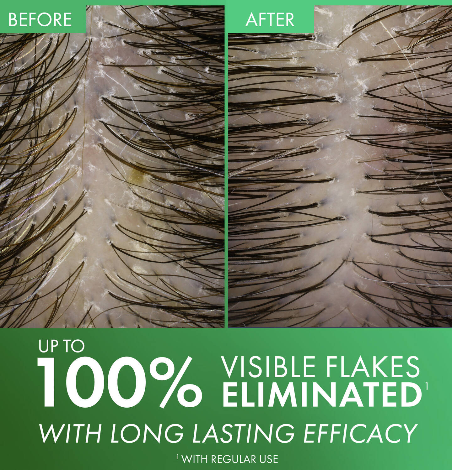 Dercos Selenium Sulfide Anti-Dandruff Shampo - Sylph Beauty