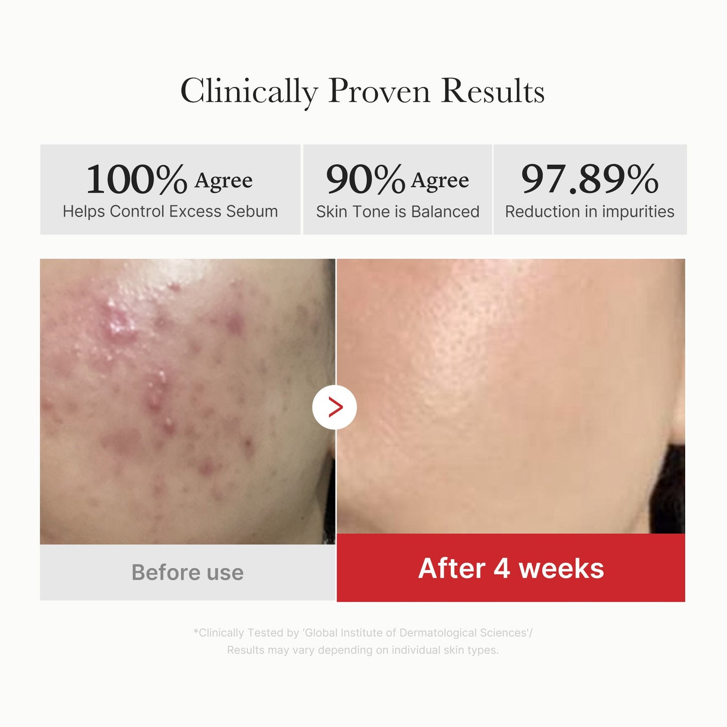 Red Succinic Acid Peeling Pads