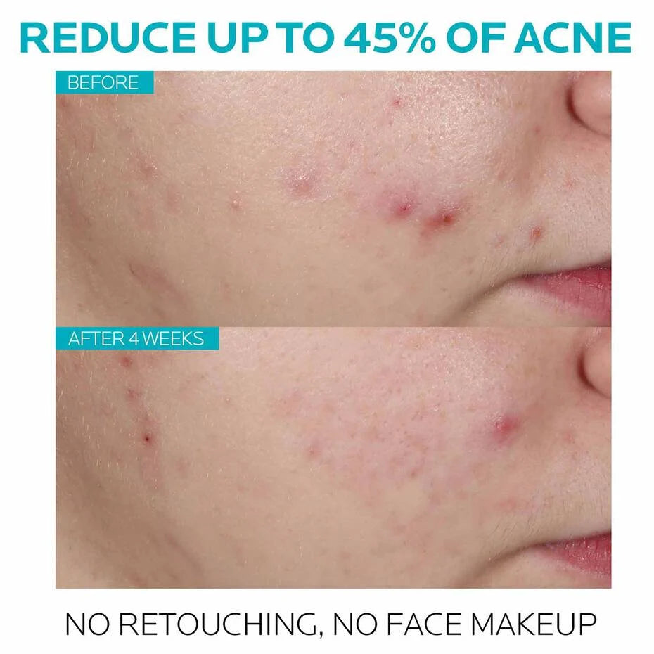 Effaclar Salicylic Acid Acne Treatment Serum - Sylph Beauty