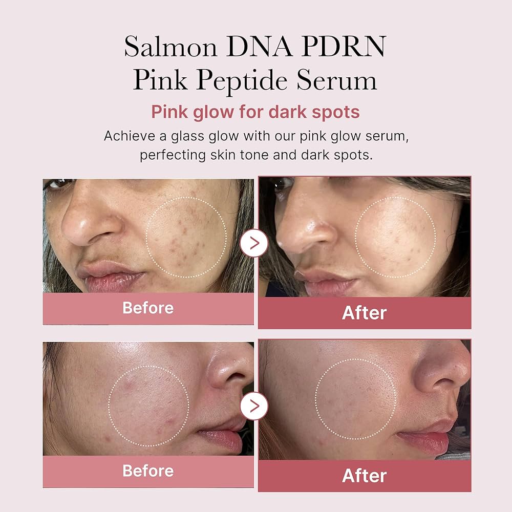 PDRN Pink Peptide Serum - Sylph Beauty