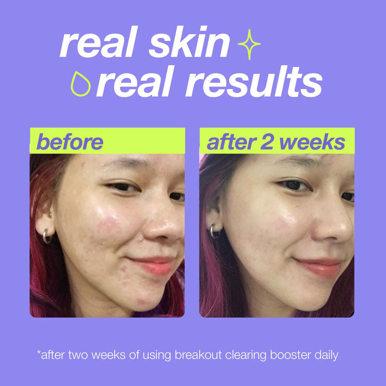 Breakout Clearing Booster - Sylph Beauty