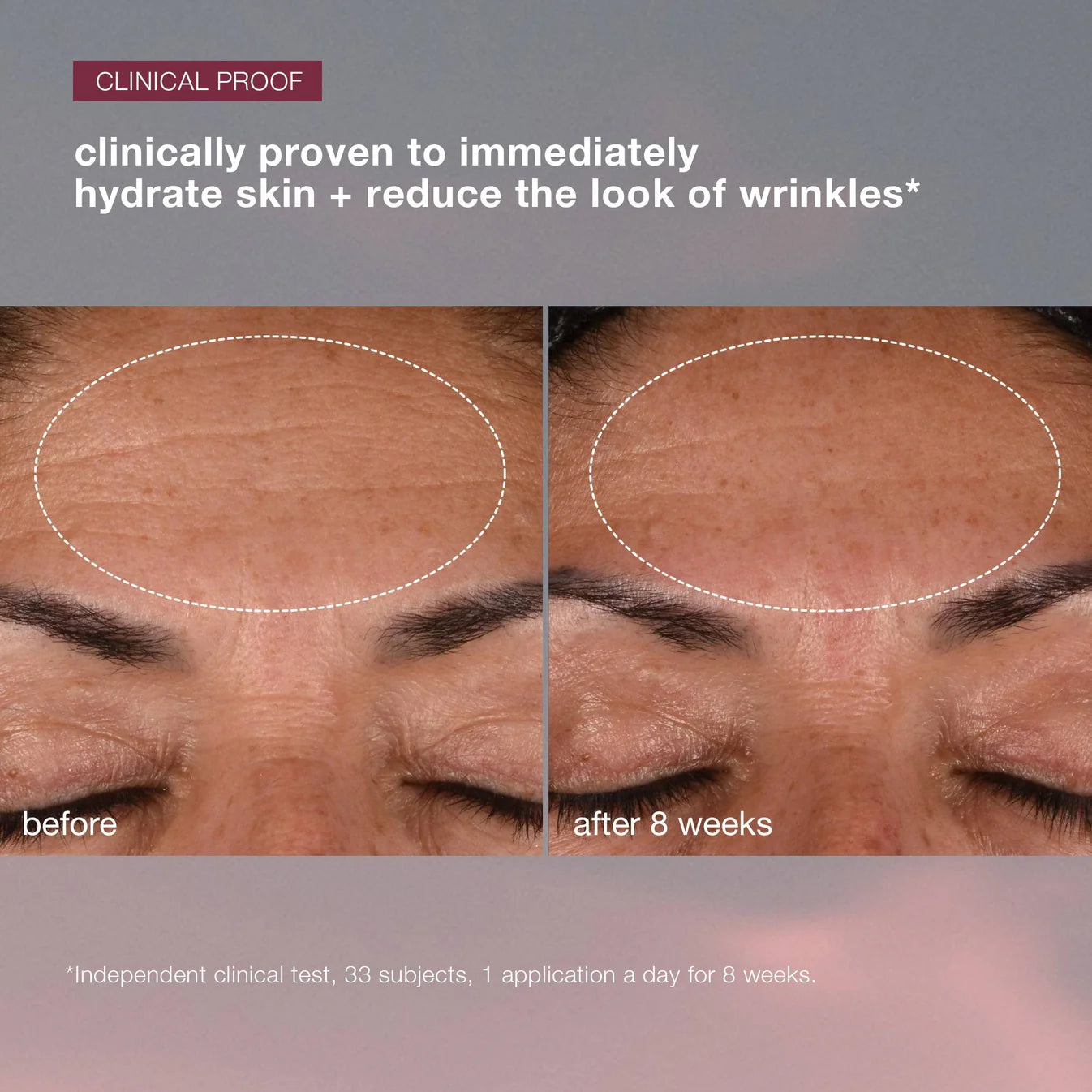 Dynamic Skin Recovery SPF50 - Sylph Beauty